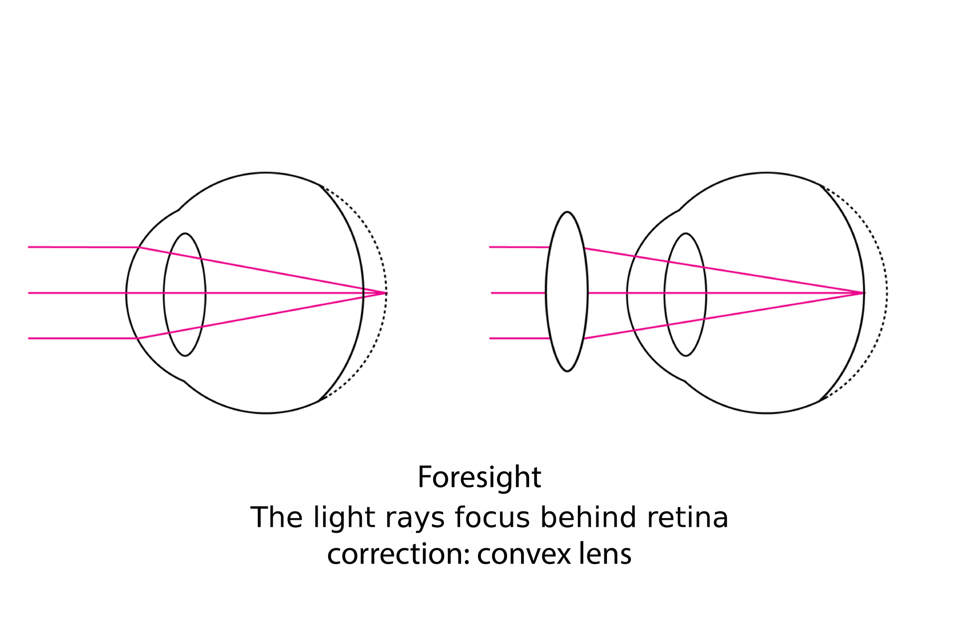 Eye The Organ Of Sight Zintegrowana Platforma Edukacyjna 6646