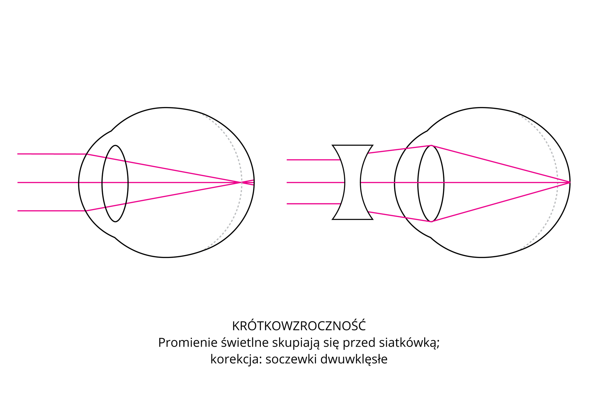 Oko Narząd Wzroku Epodrecznikipl