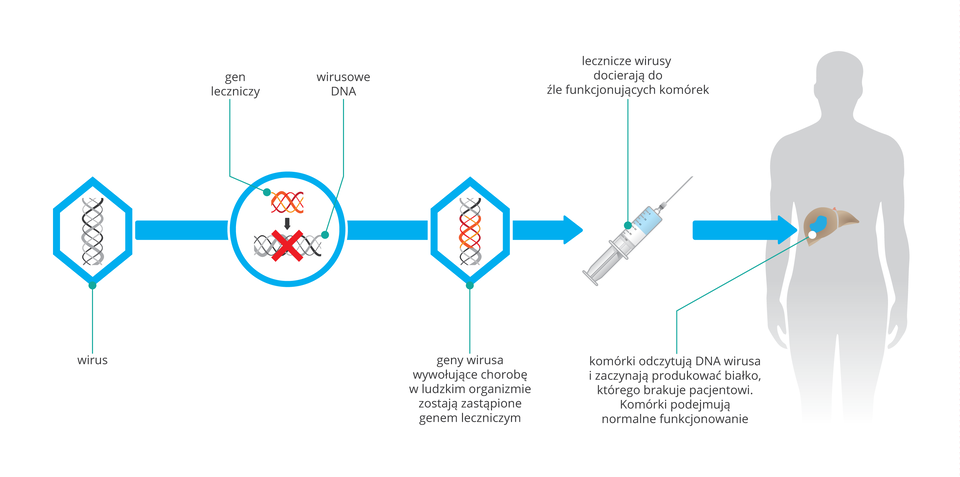 Scmematyczna ilustracja terapii genowej. Na pierwszym obrazku wirus z DNA. Na drugim wprowadzenie do DNA wirusowego fragmerntu obcego DNA. Obrazek 3: geny wirusa wywołujace chorobę zostają zastąpione nowo wprowdzonym genem. Obrazek 4 zmodyfikowane wirusy są pobierane w wszczepiane do wątroby.