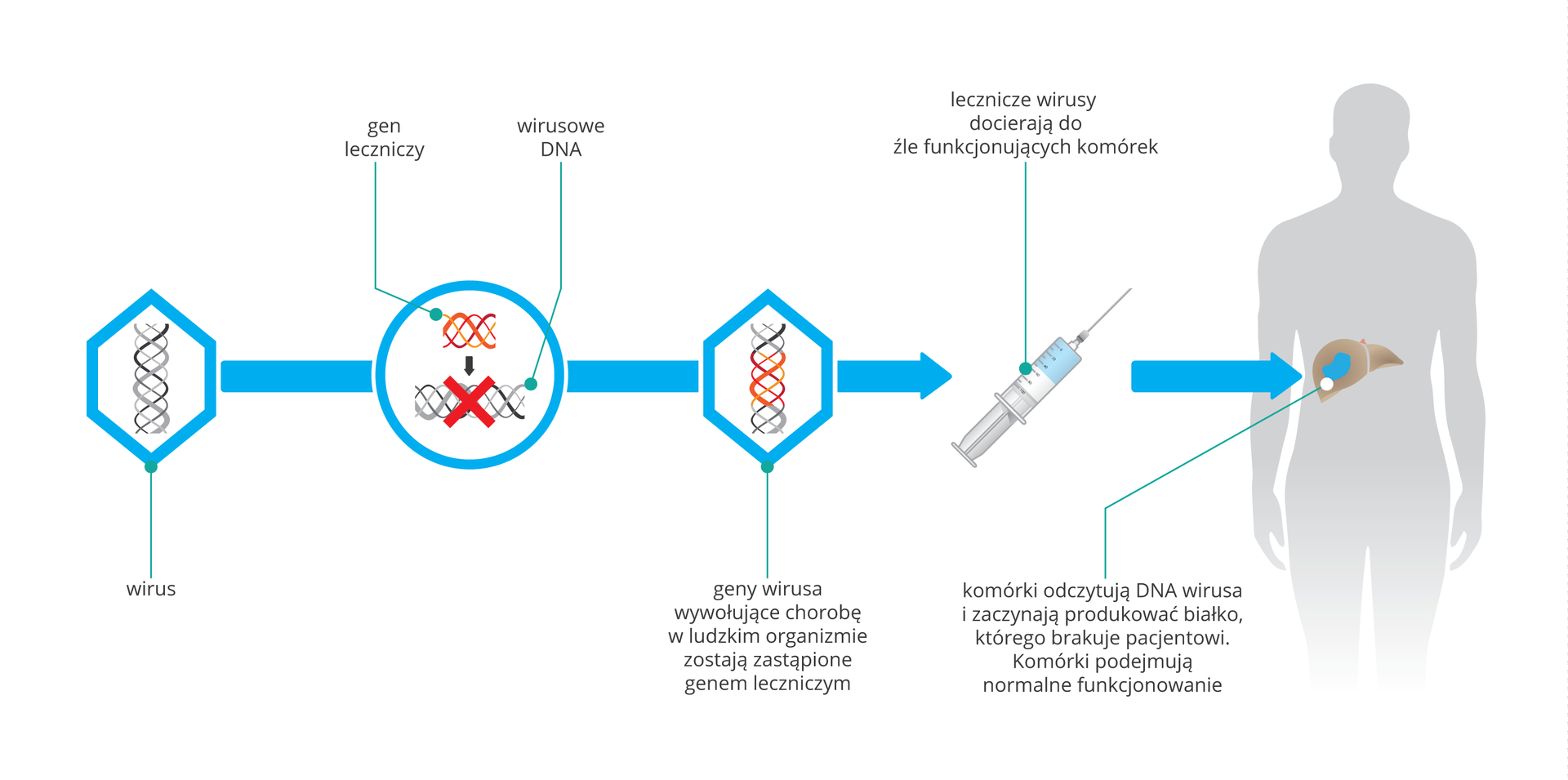 Scmematyczna ilustracja terapii genowej. Na pierwszym obrazku wirus z DNA. Na drugim wprowadzenie do DNA wirusowego fragmerntu obcego DNA. Obrazek 3: geny wirusa wywołujace chorobę zostają zastąpione nowo wprowdzonym genem. Obrazek 4 zmodyfikowane wirusy są pobierane w wszczepiane do wątroby.