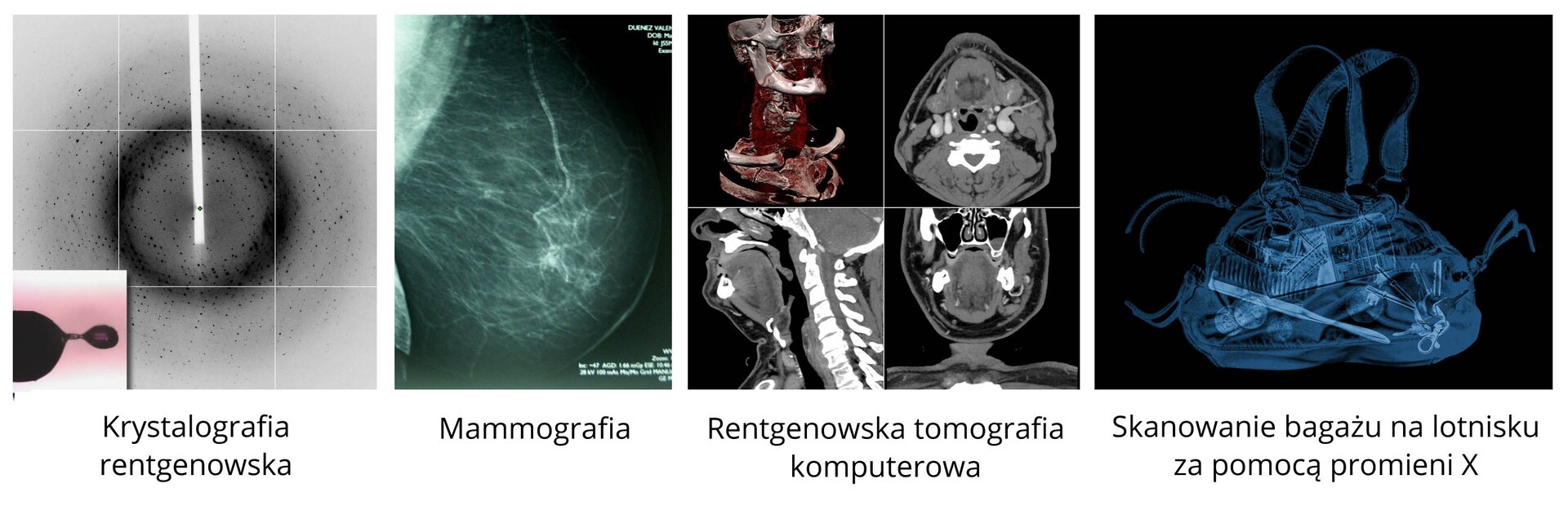 Zastosowanie promieniowania rentgenowskiego