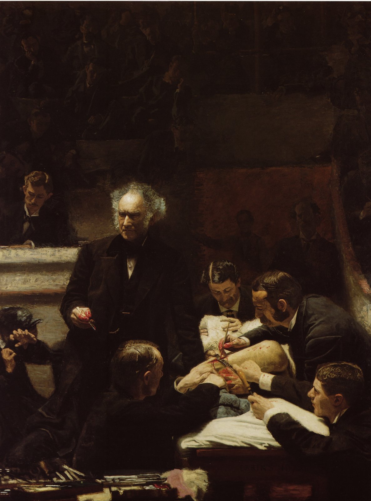 Klinika doktora Grossa Źródło: Thomas Eakins, Klinika doktora Grossa, 1875, olej na płótnie, Philadelphia Museum of Art, domena publiczna.