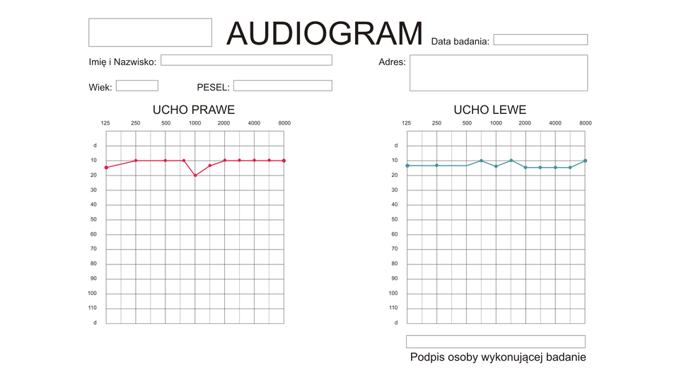 Audiogram