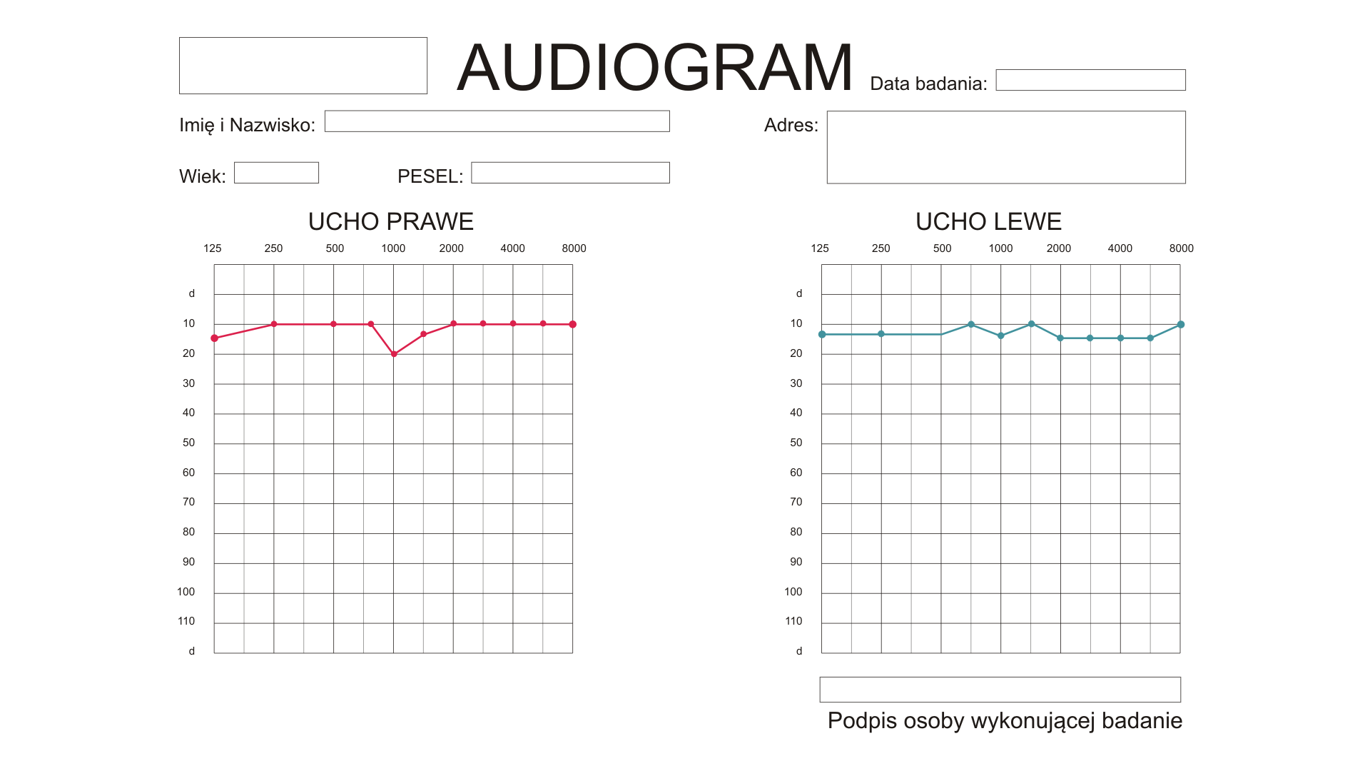 Audiogram