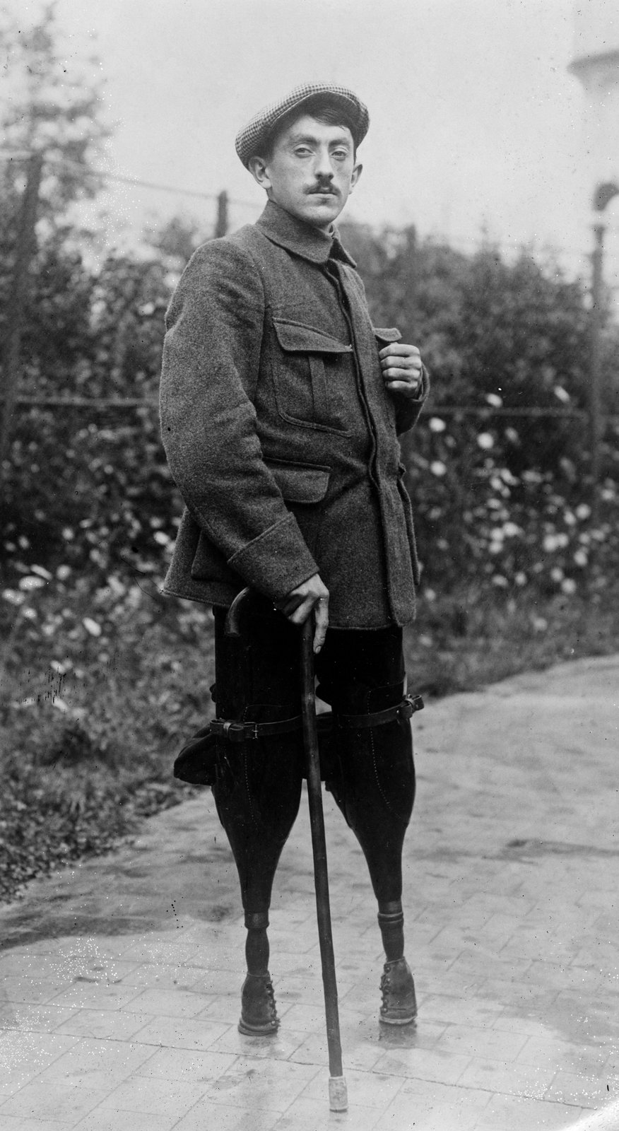 Żołnierz francuski, który stracił podczas wojny obie nogi Źródło: Żołnierz francuski, który stracił podczas wojny obie nogi, Fotografia, Biblioteka Kongresu Stanów Zjednoczonych, domena publiczna.