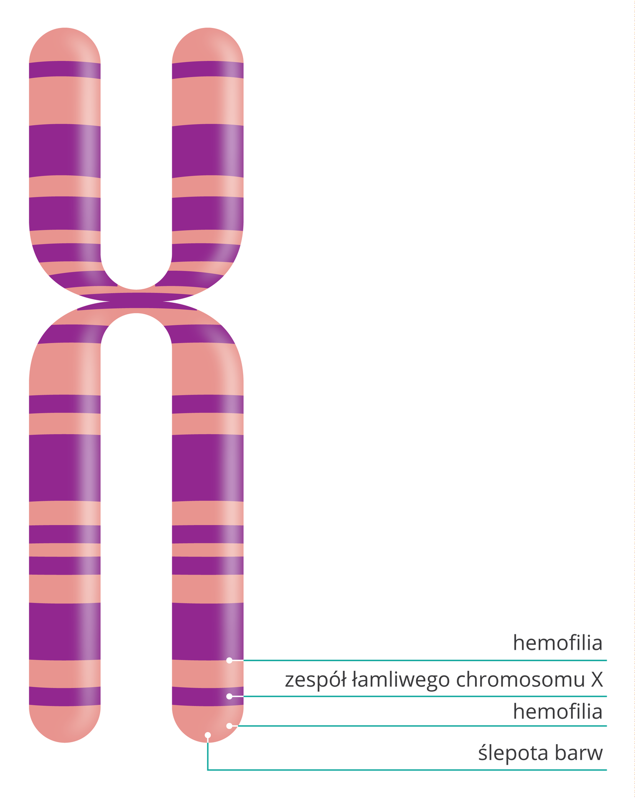 Ilustracja przedstawia schematycznie różowy chromosom X zfioletowymi poprzecznymi paskami różnej szerokości. Paski ilustrują umiejscowienie alleli, w tym chorób sprzężonych z płcią. Podpisy przy paskach: rozszczep podniebienia, hemofilia, zespół łamliwego chromosomu X, u dołu ślepota barw.