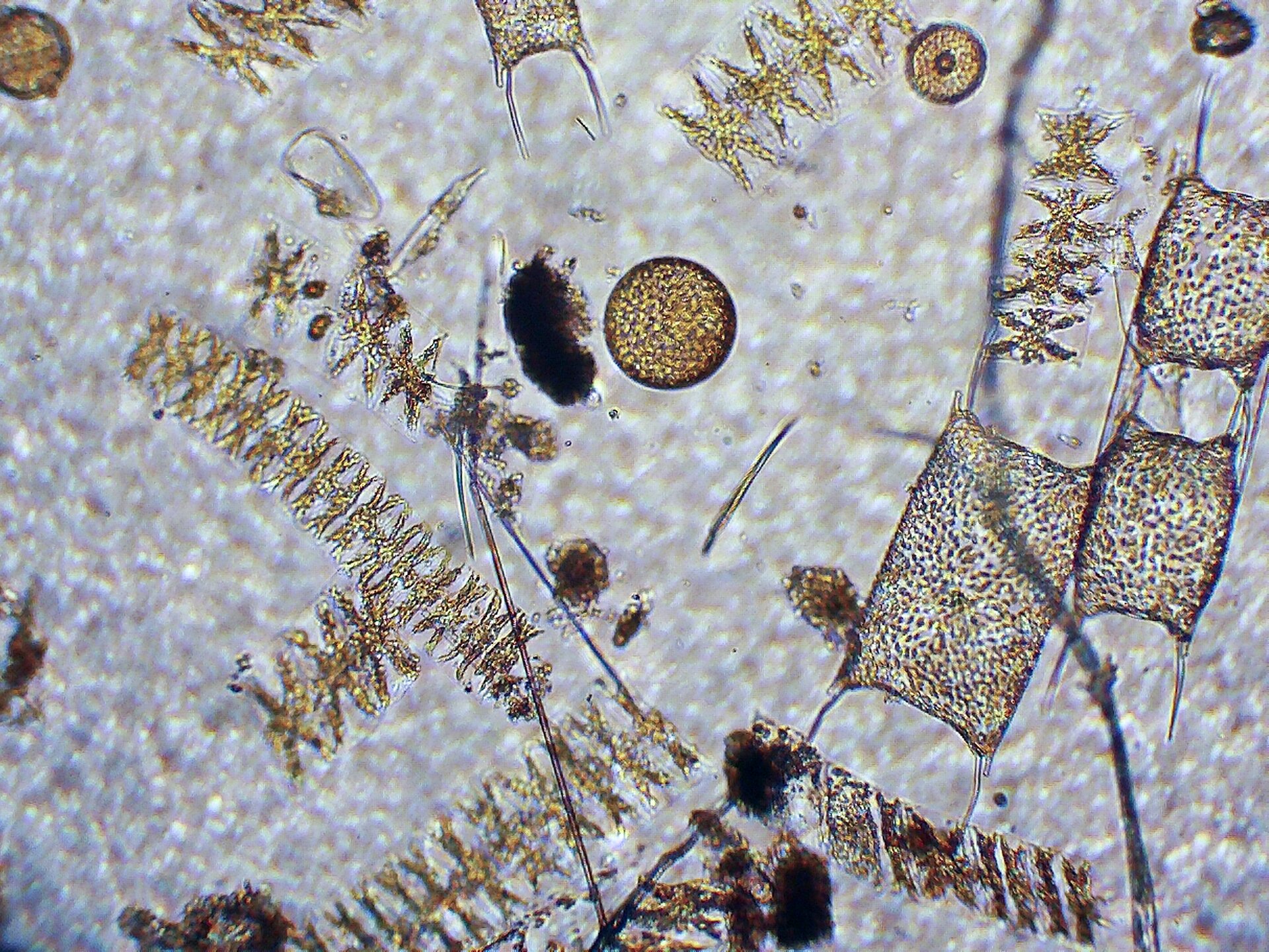 Fotografia wykonana spod mikroskopu przedstawia plankton znajdujący się w wodzie. Plankton ukazany w dużym powiększeniu składa się z organizmów o różnych kształtach: kulistym, prostokątnym, taśmowatym. Organizmy planktonowe są prześwitujące z widocznymi strukturami różnego kształtu wewnątrz, np. chloroplastami w kształcie gwiazdy u glonu taśmowatego.