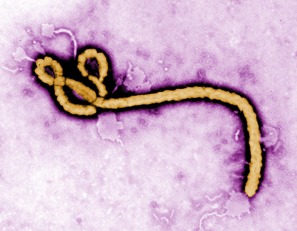 Zdjęcie przedstawiające wirus Ebola